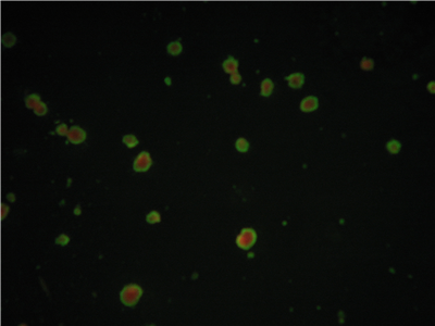 膜免疫荧光法检测血清水痘