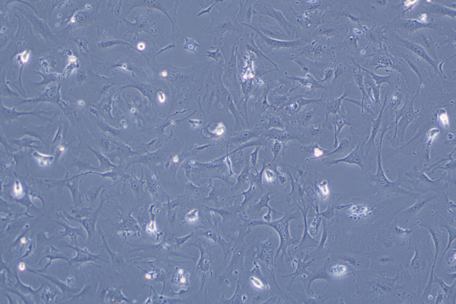 day 5 新生小鼠心肌成纤维细胞.jpg