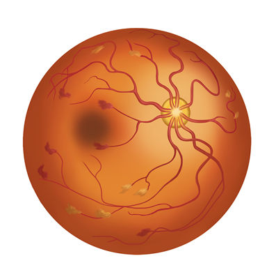 视网膜类器官